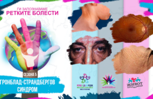 Ги запознаваме ретките болести: Гронблад-Страндбергов синдром