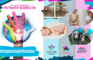 Ги запознаваме ретките болести: Псевдоахондроплазија