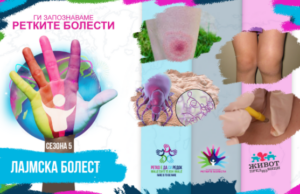 Ги запознаваме ретките болести: Лајмска болест