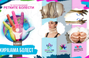 Ги запознаваме ретките болести: Хирајама болест