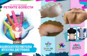 Ги запознаваме ретките болести: Фациоскапулохумерална мускулна дистрофија