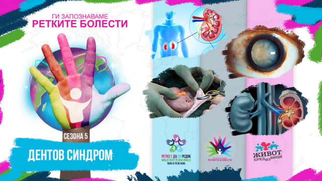 02-dent-syndrome-640x360-1