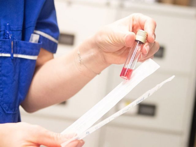 test-kovid-reagens-640x481-1