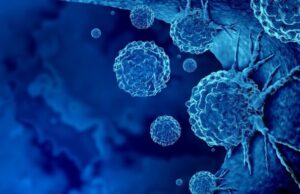 Кинески научници развиле батерија што помага при уништување на туморите