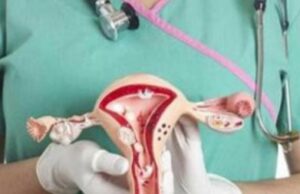 Лекари извадиле циста на јајници тешка 100 килограми