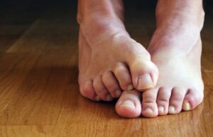 Ослободете се од шилецот во петицата