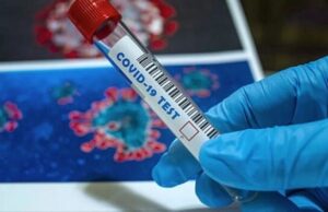 Нов сој на коронавирус регистриран во 36 земји ширум светот