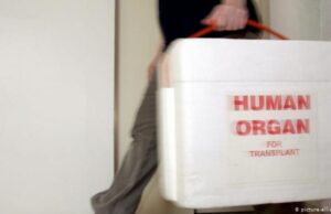 Д-р Мојсова Мијовска: Дарувањето органи да биде државна стратегија