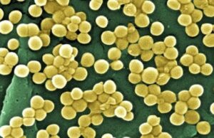 Откриен е „Зосурабалпин“, нов антибиотик што делува против смртоносни супербактерии