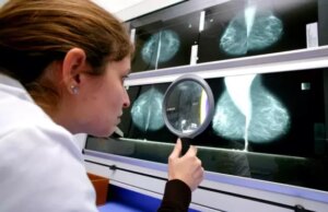Германски лекари тестираат нов вид на радиотерапија за болните од рак