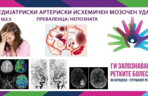 Ги запознаваме ретките болести во охридско – струшкиот регион: Педијатриски артериски исхемичен мозочен удар