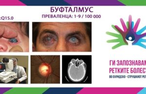 Ги запознаваме ретките болести во охридско – струшкиот регион: Буфталмус