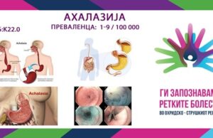 Ги запознаваме ретките болести во охридско – струшкиот регион: Ахалазија