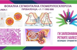 Ги запознаваме ретките болести во охридско – струшкиот регион: Фокална сегментална гломерулосклероза