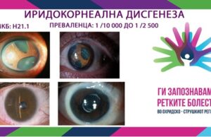 Ги запознаваме ретките болести во охридско-струшкиот регион: Иридокорнеална дисгенеза