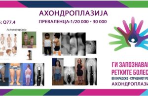 Ги запознаваме ретките болести во охридско – струшкиот регион: Ахондроплазија