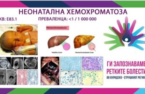 Ги запознаваме ретките болести во охридско-струшкиот регион: Неонатална хемохроматоза