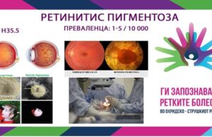Ги запознаваме ретките болести во охридско-струшкиот регион: Ретинитис пигментоза