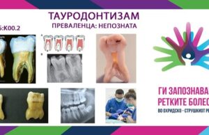 Ги запознаваме ретките болести во охридско-струшкиот регион: Тауродонтизам