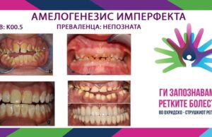 Ги запознаваме ретките болести во охридско – струшкиот регион: Амелогенезис имперфекта