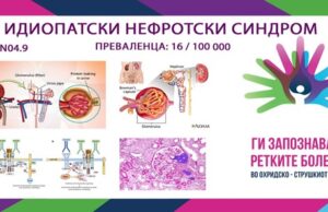 Ги запознаваме ретките болести во охридско-струшкиот регион: Идиопатски нефротски синдром