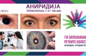 Ги запознаваме ретките болести во охридско – струшкиот регион: Аниридија