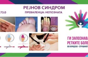 Ги запознаваме ретките болести во охридско-струшкиот регион: Рејнов синдром