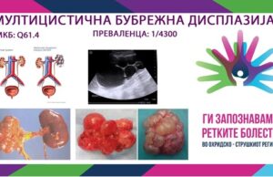 Ги запознаваме ретките болести во охридско-струшкиот регион: Мултицистична бубрежна дисплазија