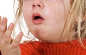 Комисијата за заразни болести денеска има состанок, во Скопје има 123 случаи на пертусис