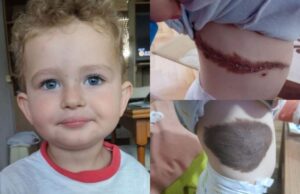 За спокоен живот на Илин – се собираат средства за третата операција