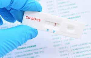 Зголемен е бројот на регистрирани случаи на Ковид, да се почитуваат препораките, апелира Таравари