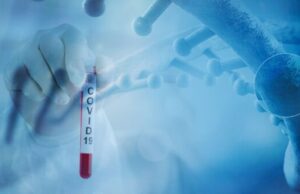 ИЈЗ: Вкупно 250 случаи на Ковид-19 во јули во Македонија