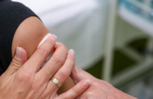 Лицата кои патуваат во Африка да се вакцинираат против мајмунски сипаници