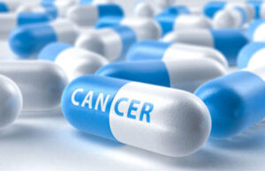 Три видови на рак кои најтешко се дијагностицираат според лекарите