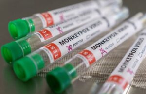 Во Индија регистриран прв случај на мајмунски сипаници