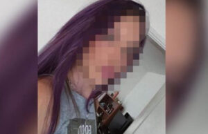 Објавена фотографија од тинејџерката која почина по вадење заб во Сараево, следеле компликации по операцијата