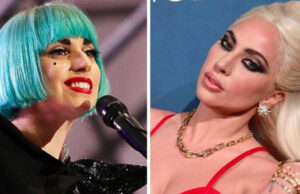 Лејди Гага негира дека имала естетска операција, експертите тврдат дека направила нешто