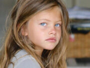 (Фото) Најубавото девојче денеска е непрепознатлива жена: ја напаѓаа, а сега остава без здив