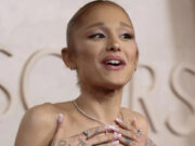 (Фото) Сè повеќе загрижува со својот изглед, но тврди дека сè е во ред: „Помогнете ѝ“