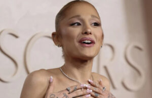 (Фото) Сè повеќе загрижува со својот изглед, но тврди дека сè е во ред: „Помогнете ѝ“