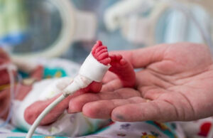 Бебе во Германија се роди со тежина од 300 грама: преживеа