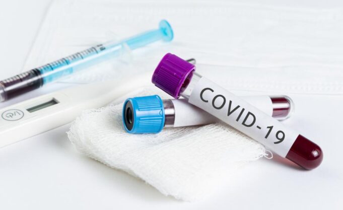 koronavirus-kovid-19-3