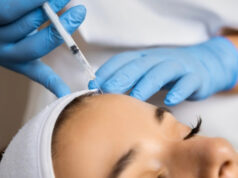 (Видео) Инфлуенсерка ги покажа последиците од ботоксот: „Не можам да се смеам, но тоа не е најлошиот дел“