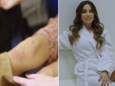 (Видео) Птиците умираат пеејќи, се пошегува Северина по падот на концерт