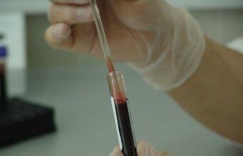 Научниците создадоа „универзална“ крв за сите типови