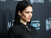 Позната манекенка ја открива вистината за пластичните операции: „Тоа беше најлошото нешто во мојот живот“