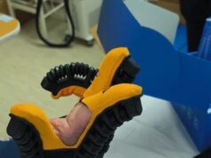 Фондацијата „Заедно за едно“ донираше на кочанската болница 90 комплети ракавици за пасивна рехабилитација