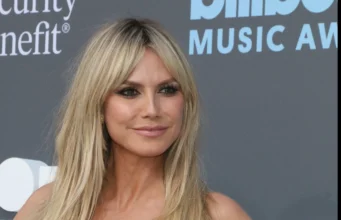 Хајди Клум проговори за дијагнозата: Тоа е моја супермоќ, а не нарушување