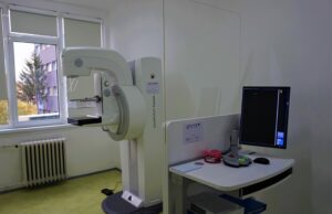 Мамографот во Штип во дефект: Пациентките ќе се снимаат во Кочани, резултатите ќе ги чита штипскиот тим