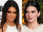 Кендал Џенер ги демантира гласините за операција: „Носот ми се промени од лекови против акни“